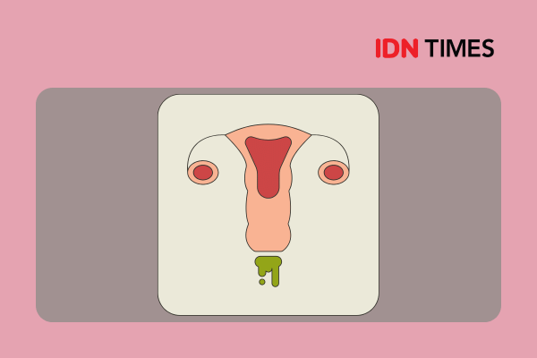Ilustrasi organ reproduksi perempuan dengan cairan keputihan berwarna hijau keluar dari vagina di latar berwarna merah muda.