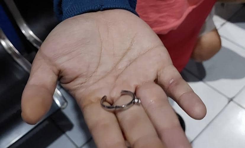 Gegera Cincin Nyangkut di Jari Manis, Pasutri di Sukabumi Datangi Damkar