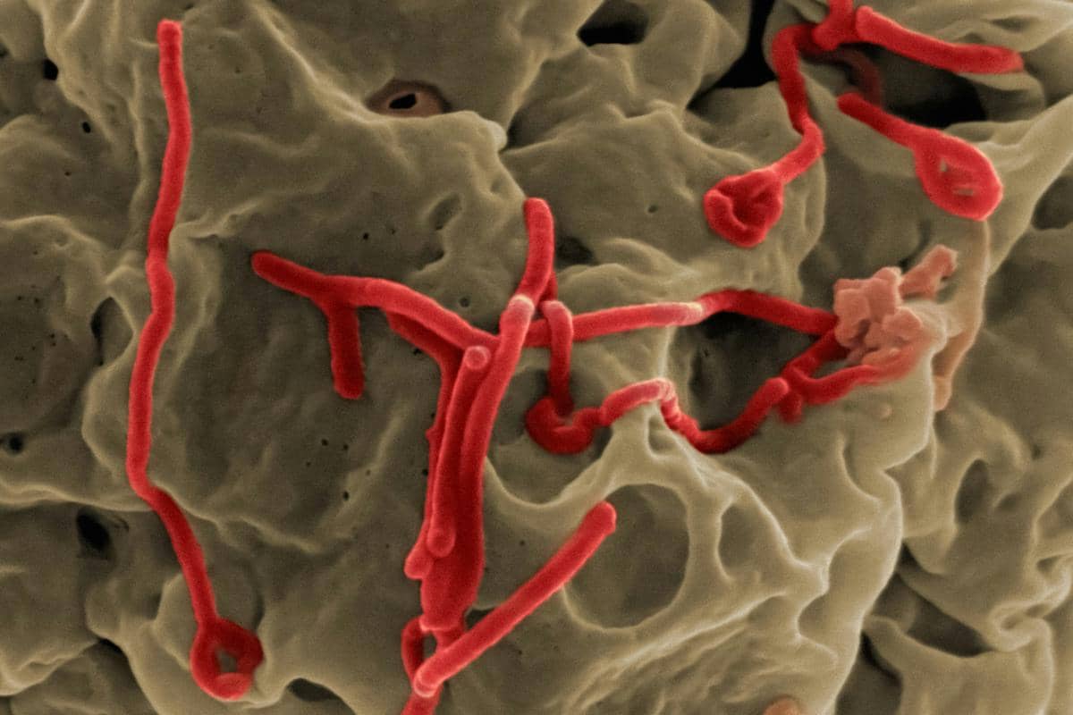 Wabah Ebola di Kongo Makin Parah, Tenaga Medis Mulai Tumbang