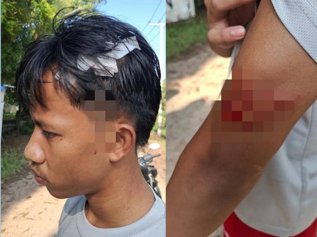 Atlet PON Tinju Lampung Dibacok Cangkul, Tiga Pelaku Ditangkap