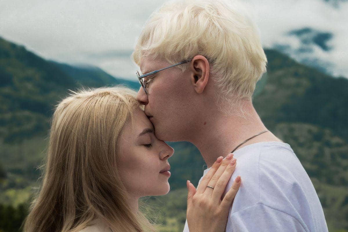 5 Makna Ciuman Dahi Ala Gen Z, Bikin Salting Brutal!