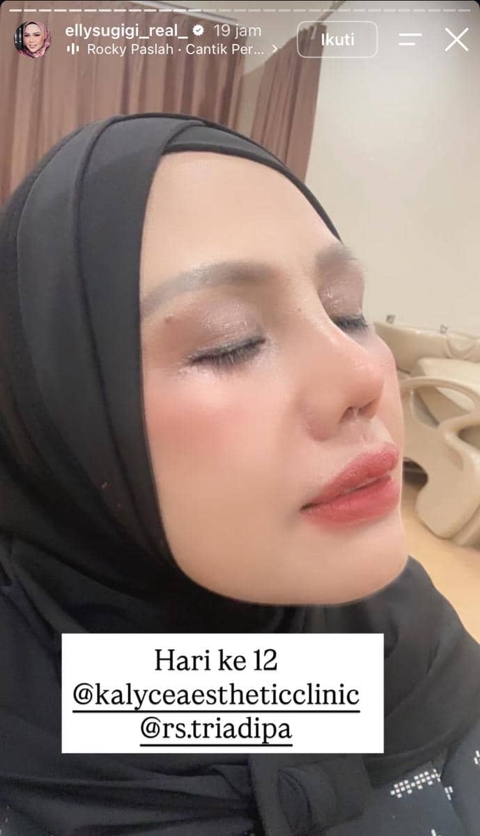 Seorang perempuan berhijab berpose dengan mata terpejam memperlihatkan wajahnya setelah menjalani perawatan estetika di klinik kecantikan.