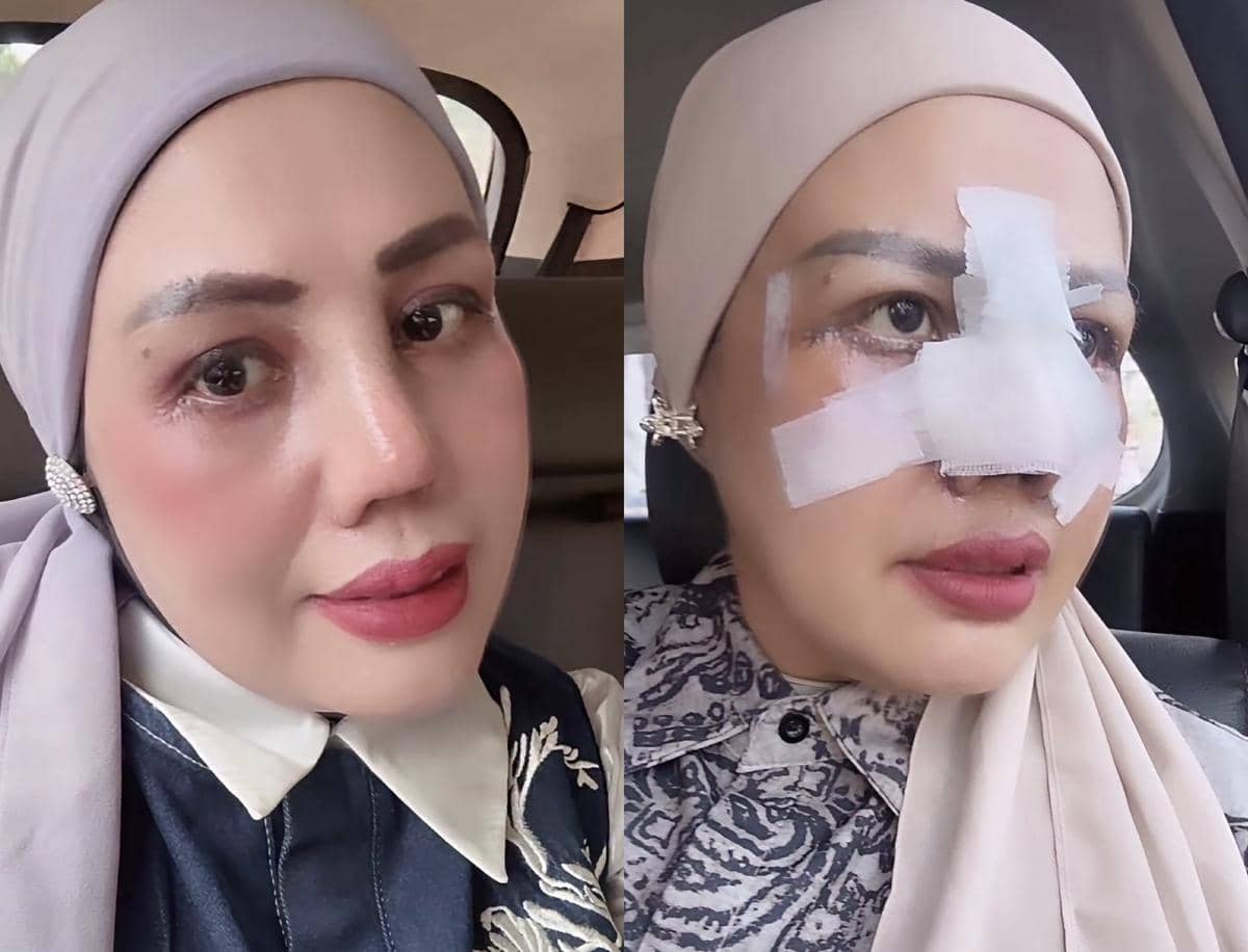 Potret Terkini Elly Sugigi Usai Oplas di 2026, Capek Fisiknya Dihina