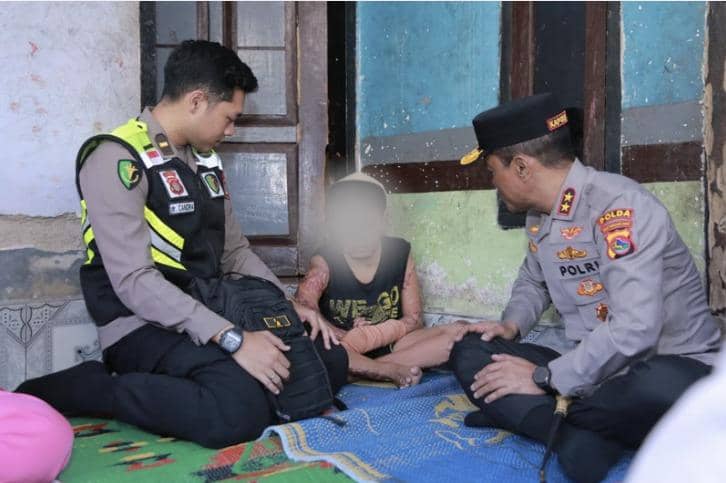 Jenguk Santri yang Dibakar Teman, Kapolda NTB: Pekan ini Tersangka Diumumkan!