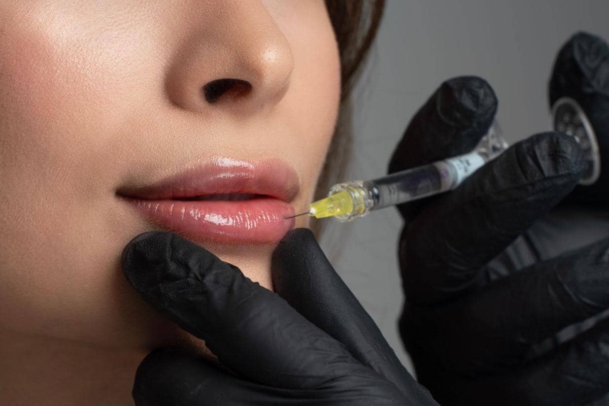 Mengenal Jenis Filler, Manfaat, dan Efek Sampingnya