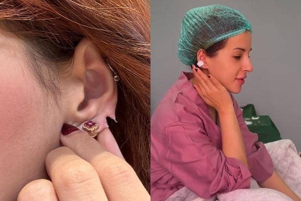 7 Potret Tasya Farasya Operasi Telinga karena Robek, Kok Bisa?