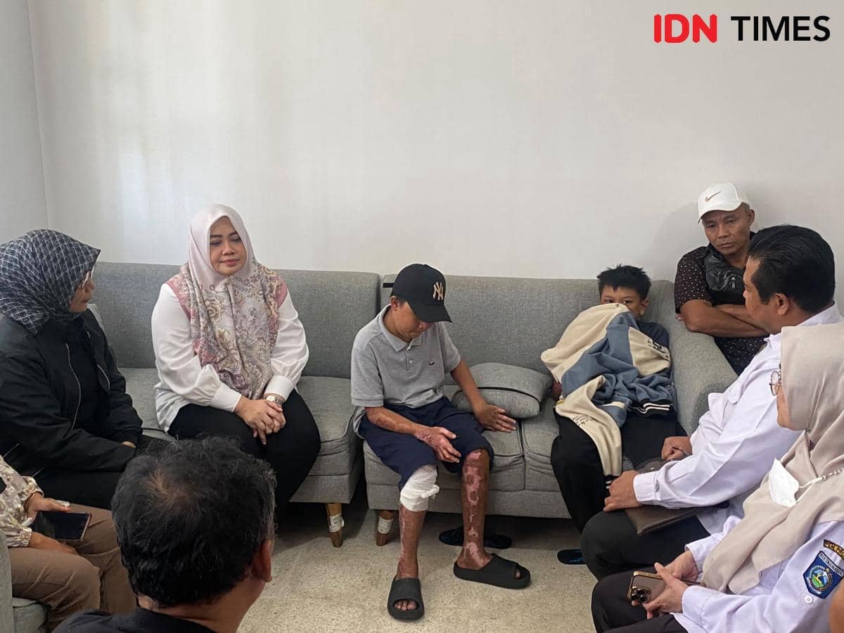 Santri Korban Pembakaran akan Jalani Operasi Cangkok Kulit di RSUD NTB