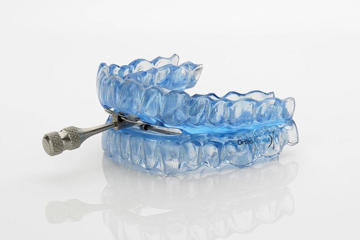 Alat ortodontik Orthoapnea berwarna biru transparan dengan komponen logam di sisi samping untuk membantu perawatan gangguan tidur.