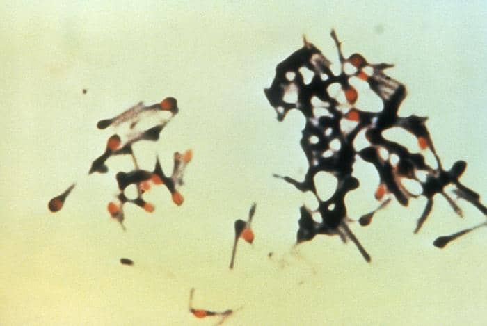 Gambar mikroskopis Clostridium tetani, bakteri berbentuk batang penyebab penyakit tetanus dengan pewarnaan laboratorium.