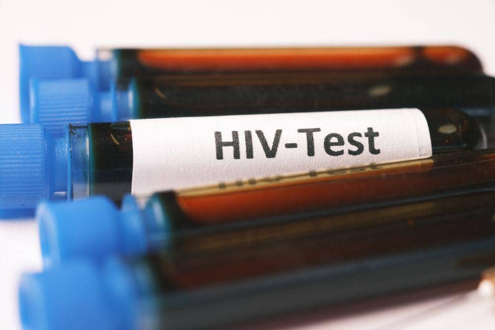 ilustrasi HIV