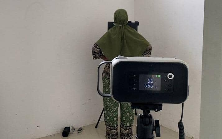 Percepat Deteksi TBC, Pemprov Sulsel Gencarkan Portable X-Ray