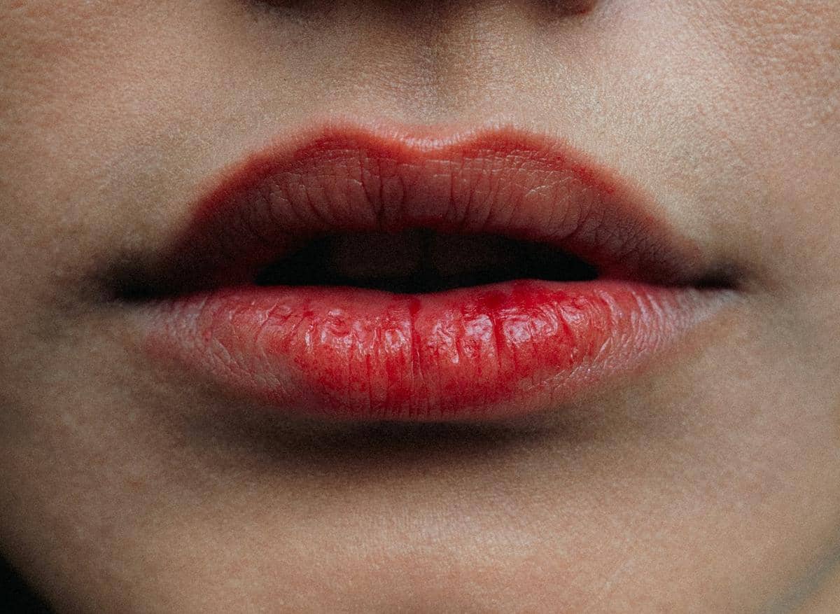 Kenapa Bibir Mudah Pecah Saat Cuaca Dingin? Ini Alasannya!