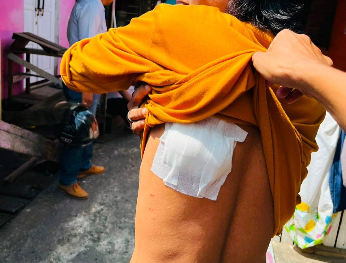 Diserang Monyet, 10 Warga Inhil Riau Terluka