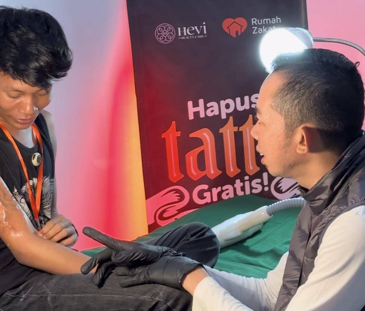 Program Hapus Tato Diikuti Sejumlah Remaja di Pontianak