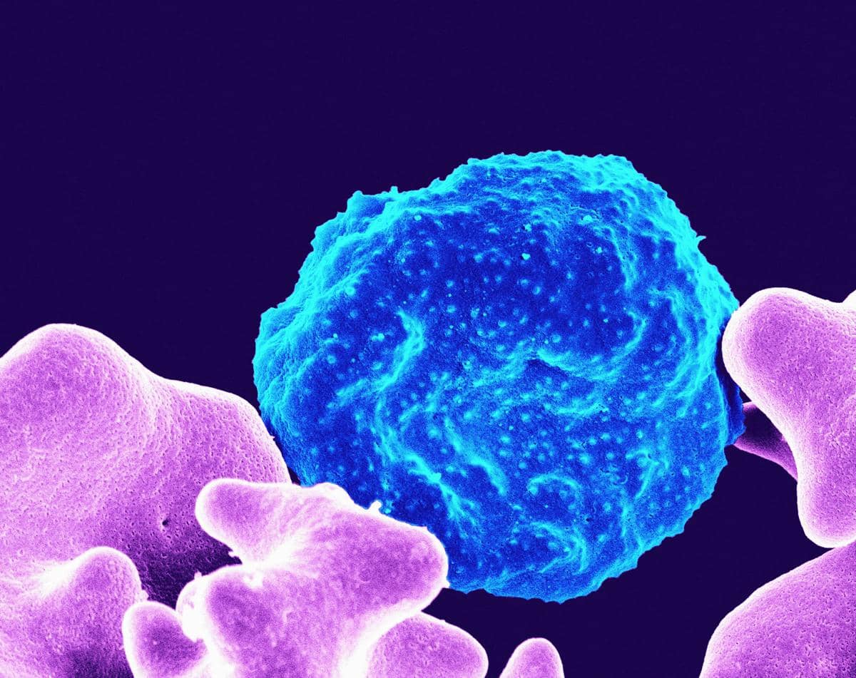 AS Umumkan Dua Kematian Pertama akibat Wabah Siklosporiasis