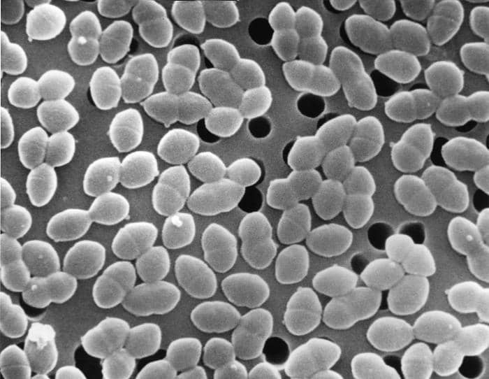 Ilustrasi mikroskopis bakteri Enterococcus faecium berbentuk bulat yang tampak berkelompok di permukaan.