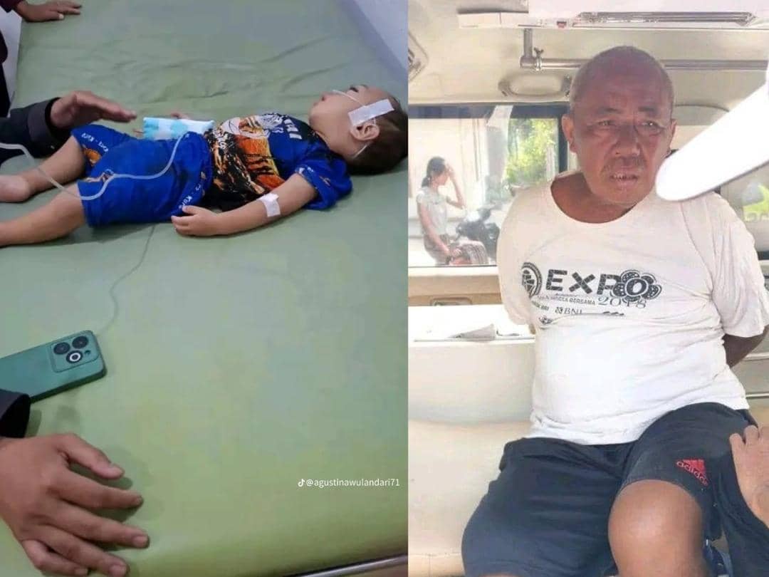 Pria ODGJ Lempar Batu ke Balita di Lamtim, Mata Korban Lebam