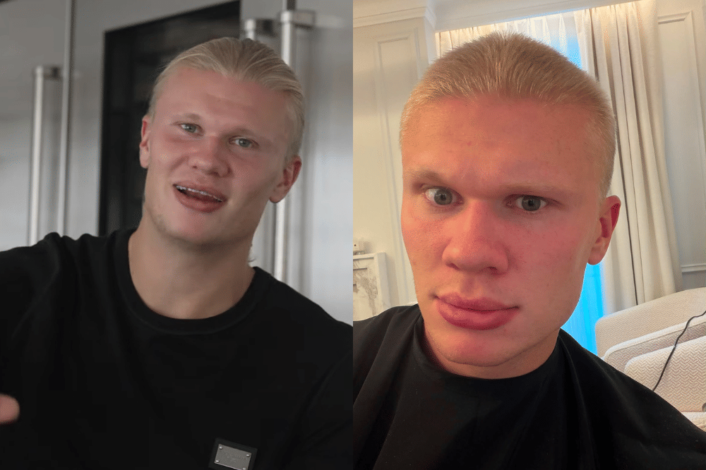 8 Potret Erling Haaland Potong Rambut Jadi Buzz Cut, Pangling Banget!