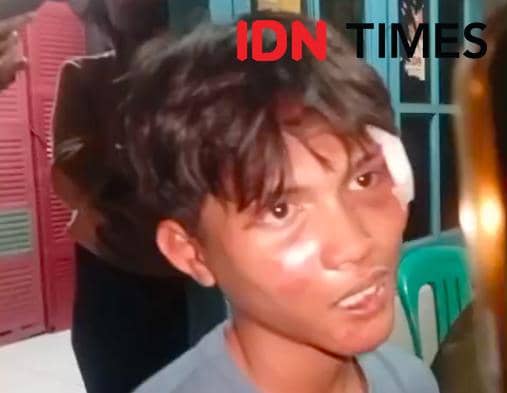 Pengakuan Pelajar Diseret dan Dipukuli Oknum Polisi Buntut Aksi Demo