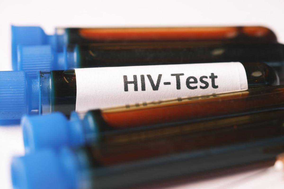 AS Setop Bantuan Dana Penanganan HIV di Namibia Setelah 20 Tahun
