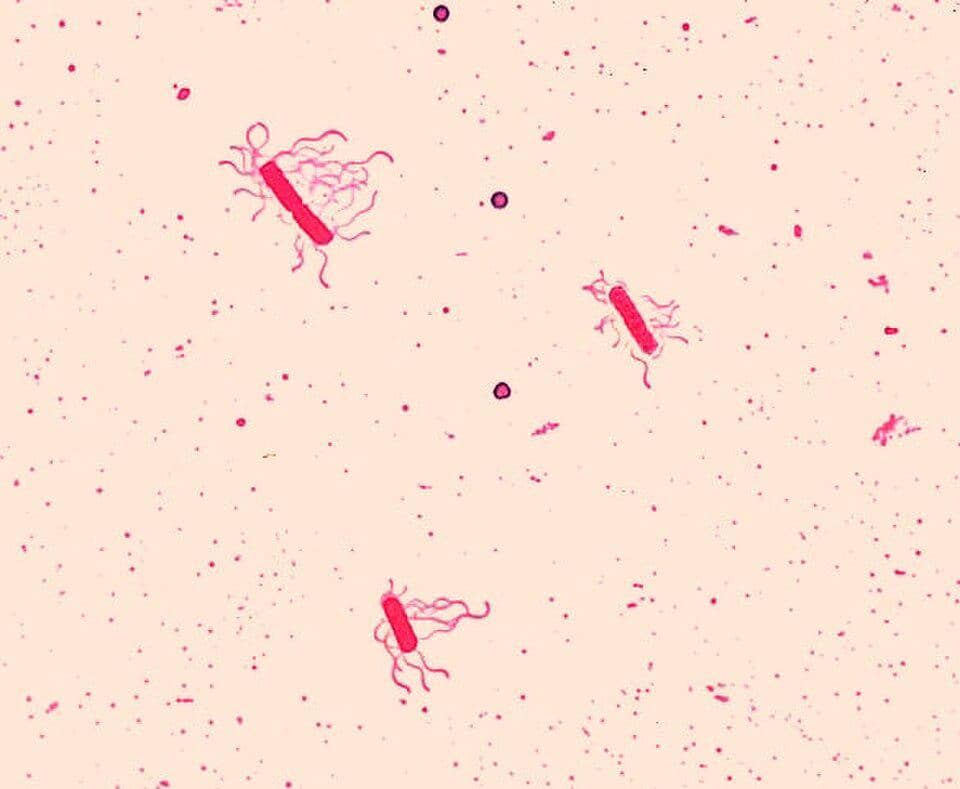 Bacillus cereus, Bakteri yang Bisa Sebabkan Keracunan Makanan