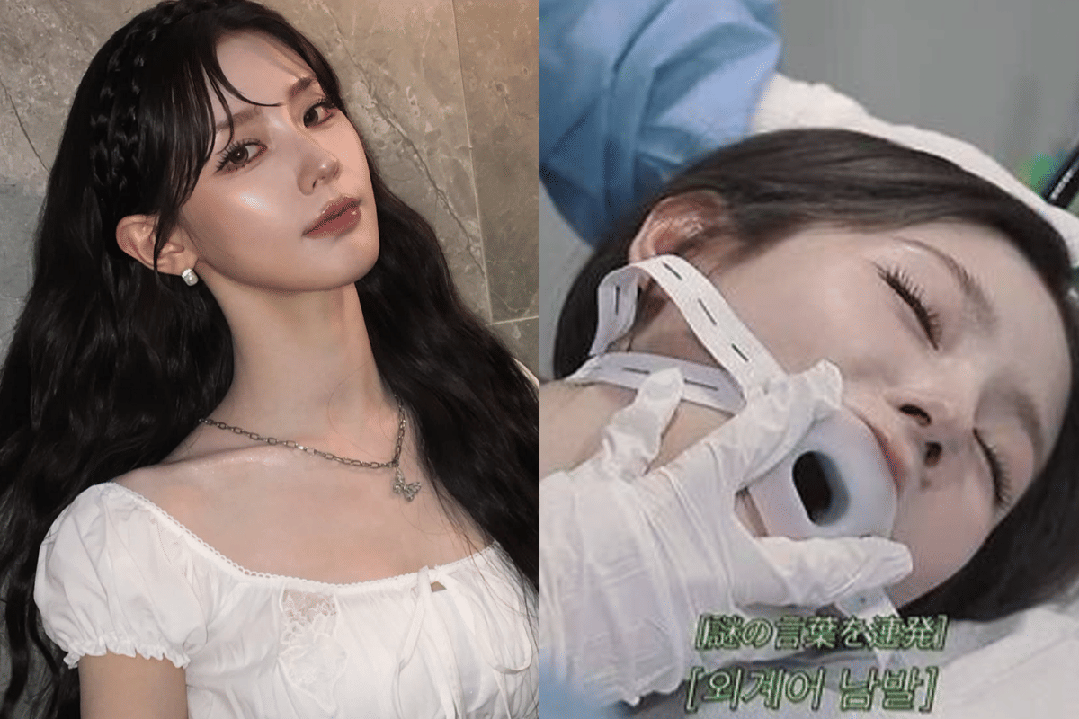 Vlog Endoskopi Miyeon i-dle Diadukan, Dituding Langgar Hukum Kesehatan