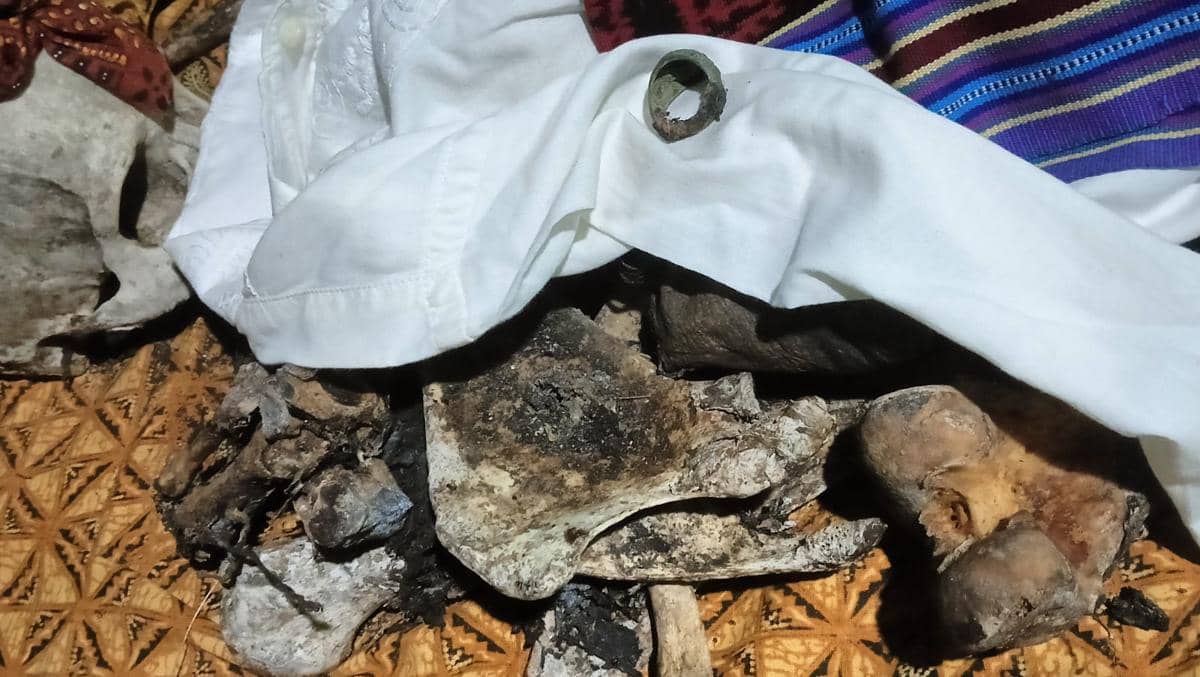 Kerangka lansia tergeletak di kawasan hutan di Kupang dalam dokumentasi Kepolisian Resor Kupang setempat.