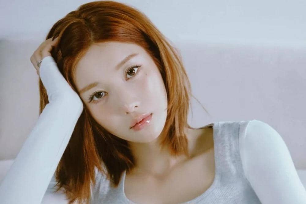 Kwon Eunbi Bagikan Kabar Terkini Abis Kecelakaan: Aku Baik-baik Saja!