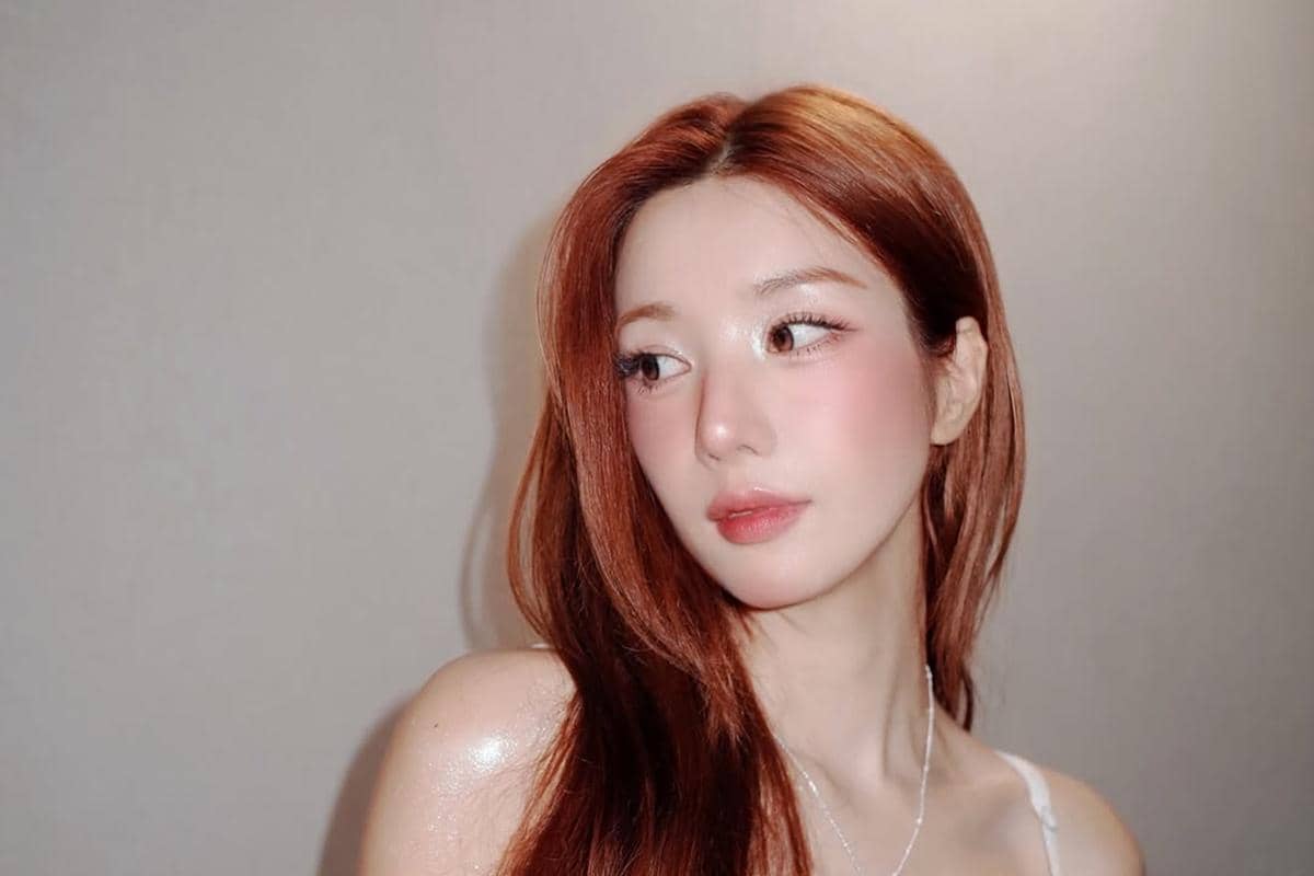 Kwon Eunbi Alami Kecelakaan Mobil, Bagaimana Kondisinya?