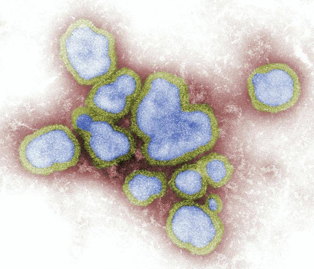Virus influenza A dilihat dari mikroskop