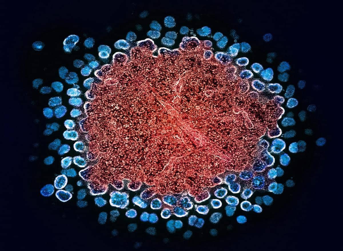 ilustrasi virus HIV