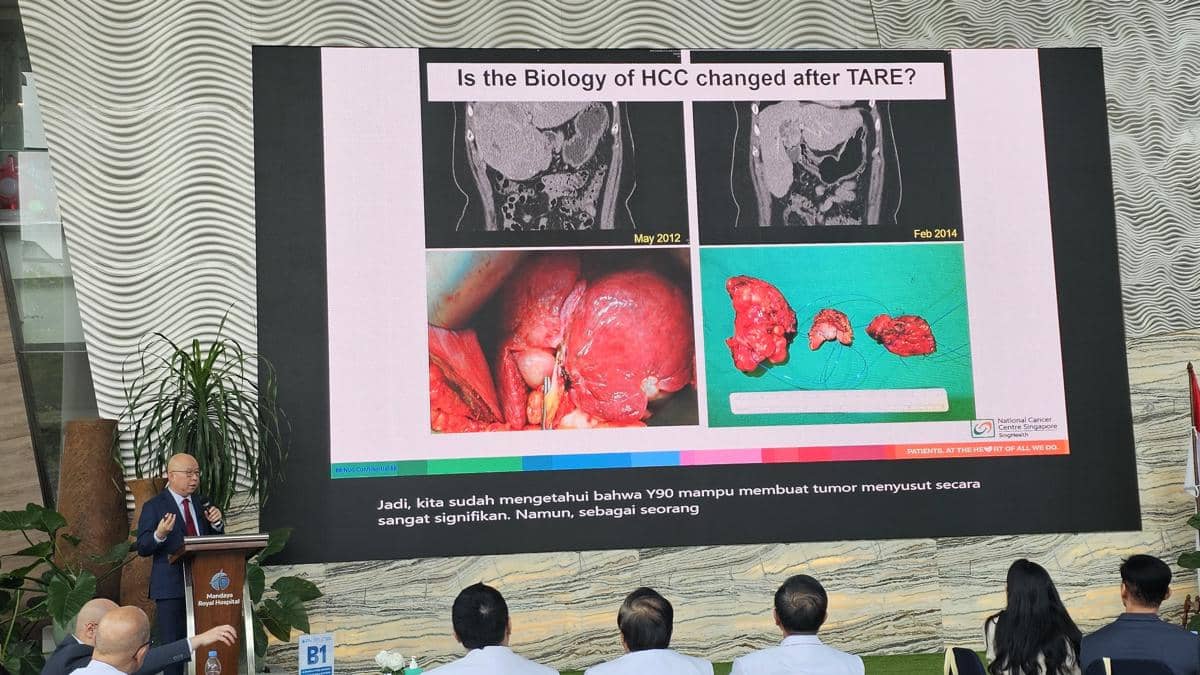 Kanker Hati Bisa Diobati dengan Terapi Radiasi Internal, Ini Cara Kerjanya