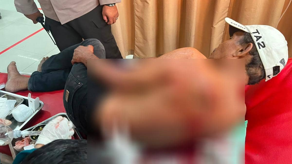 Petugas SPBU di Mamuju Dibacok Usai Tegur Sopir Truk Serobot Antrean