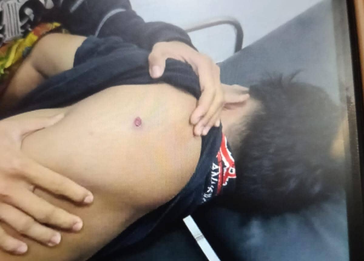 Luka pada punggung kiri korban diduga bekas tembakan peluru tajam/Dok. Istimewa