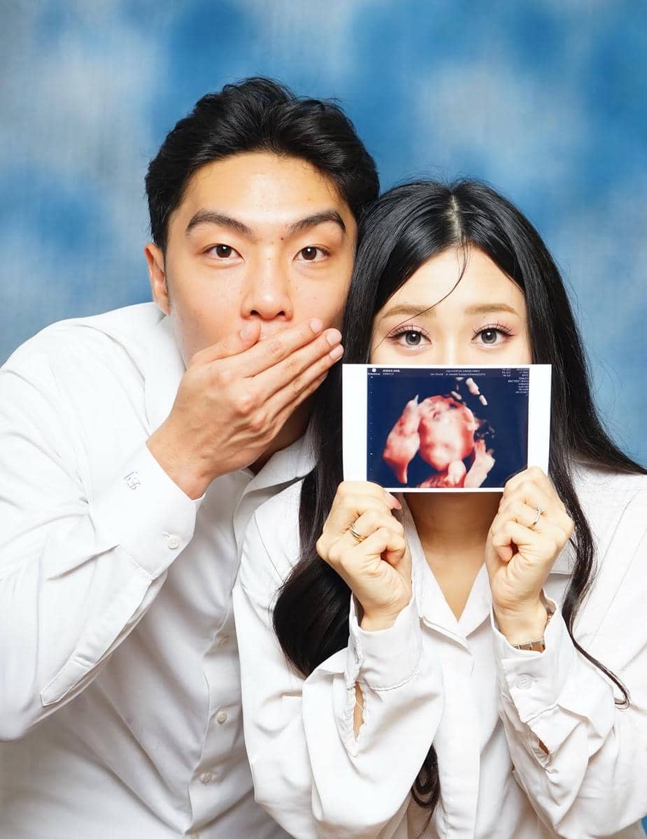 Jessica Jane dan Erwin Phang umumkan kehamilan pertama