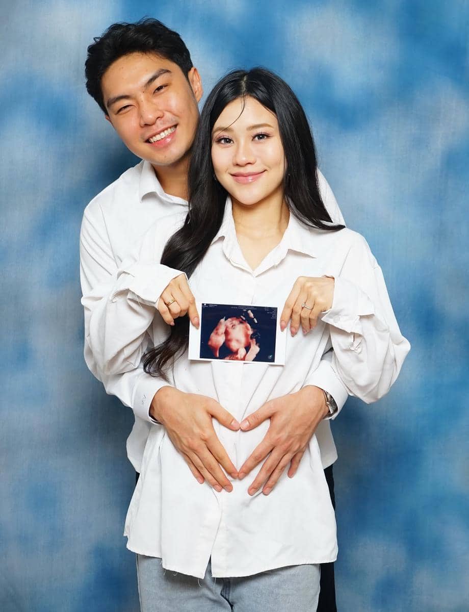 Jessica Jane dan Erwin Phang umumkan kehamilan pertama