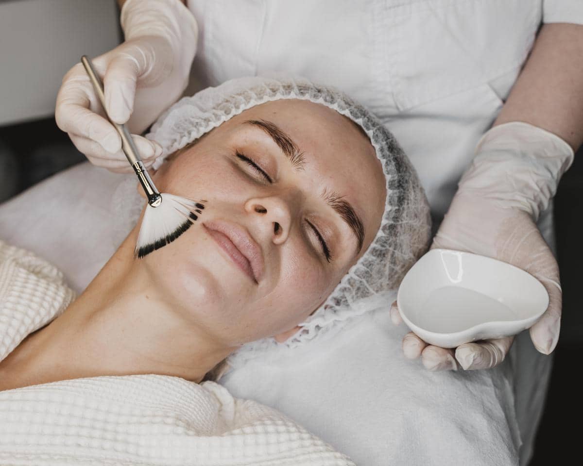 Treatment Chemical Peeling Idealnya Sebulan Berapa Kali?