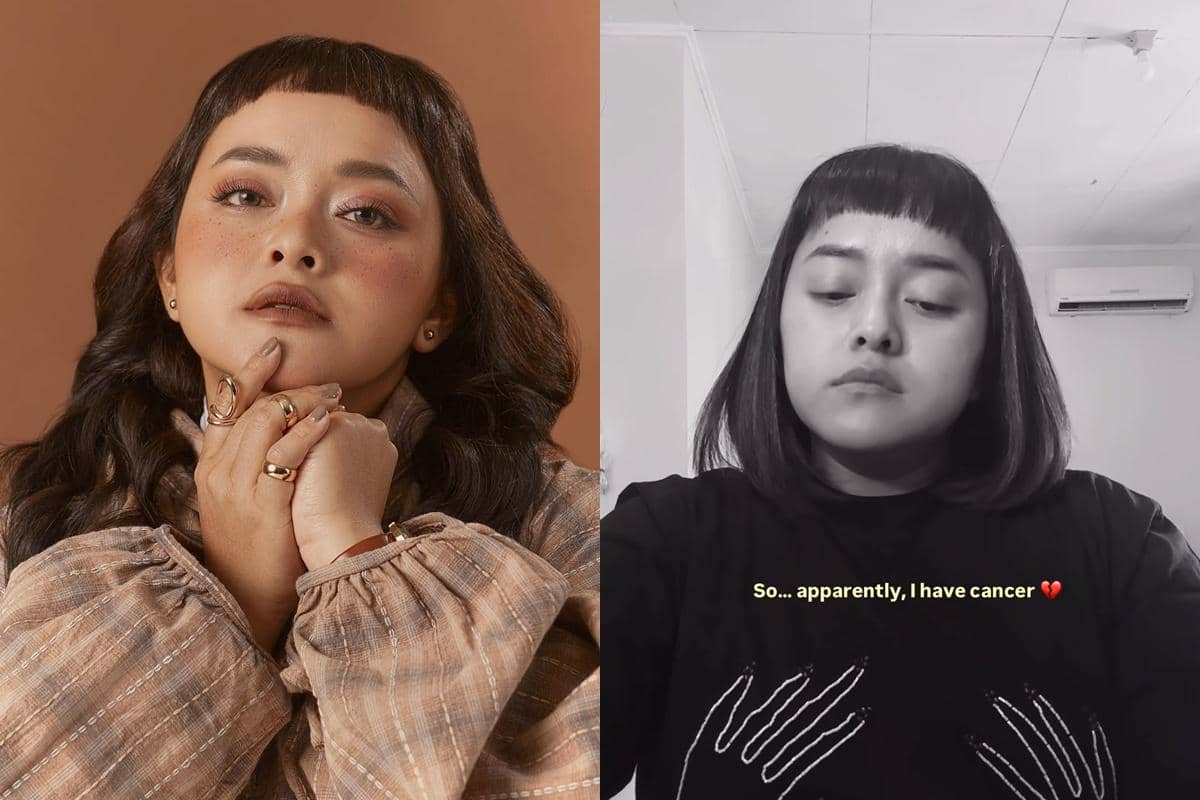 Influencer Lizzie Parra Ungkap Idap Kanker: Aku Masih Mencerna Semuanya