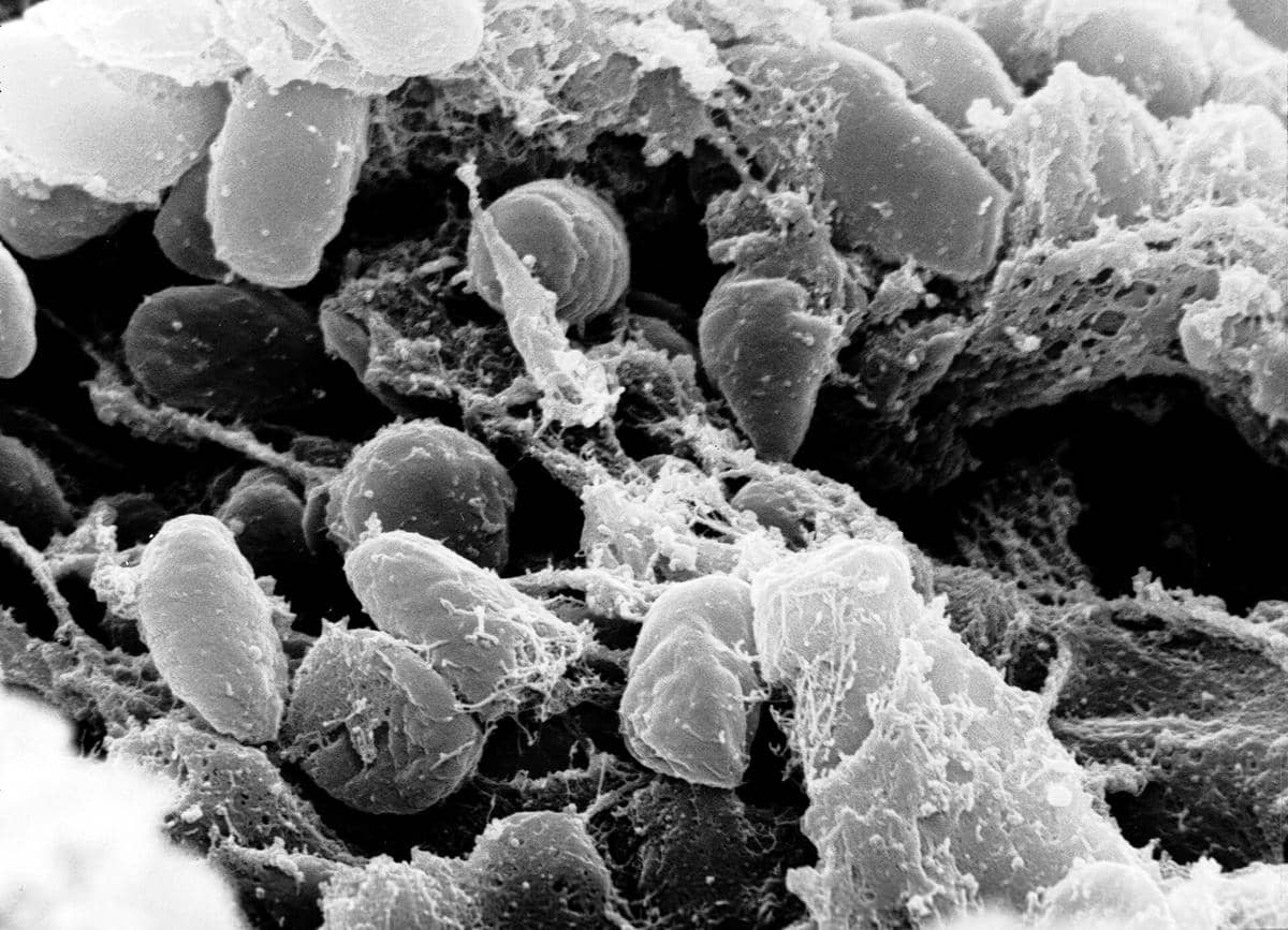 Ilustrasi mikroskopis bakteri Yersinia pestis berbentuk batang pendek dengan warna ungu dan latar belakang terang.