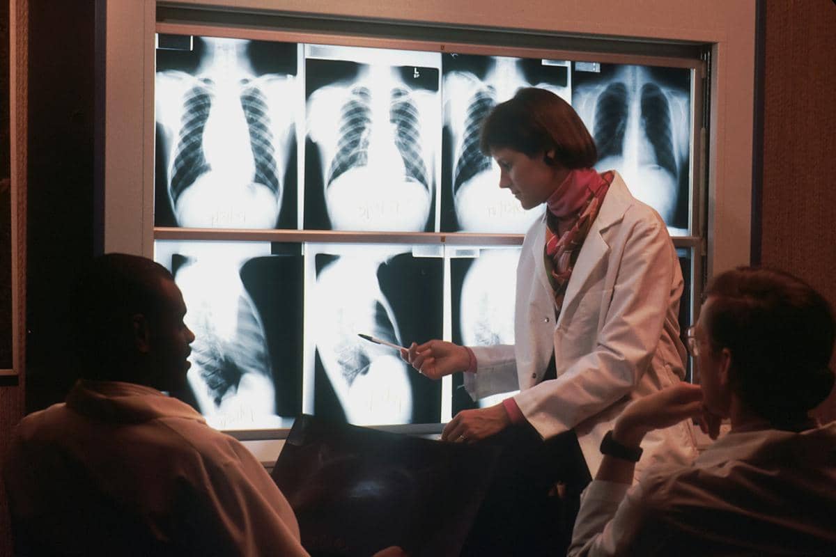 ilustrasi foto rontgen yang diteliti dokter