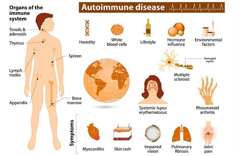 ilustrasi penyakit autoimun 