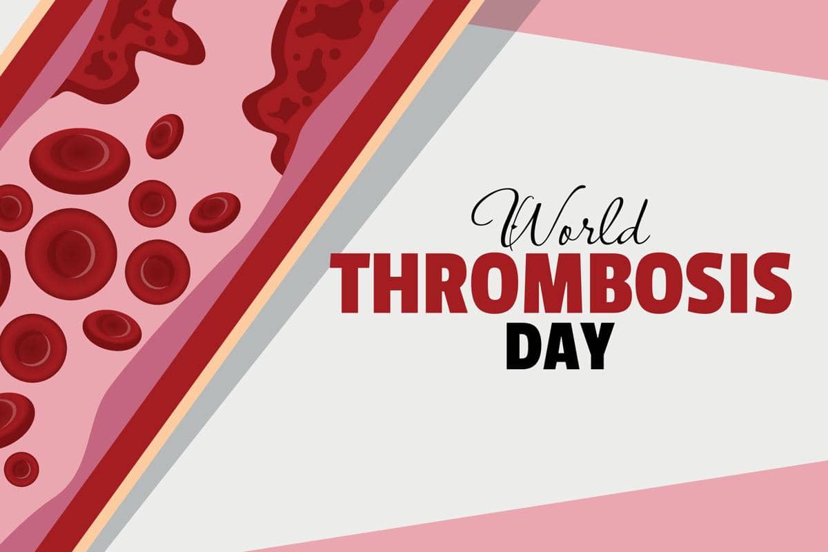 World Thrombosis Day 2026: Kenali Risiko dan Tanda Bekuan Darah