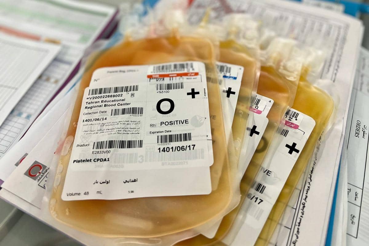 Ilustrasi transfusi trombosit atau platelet transfusion sebagai prosedur pemberian komponen darah kepada pasien.