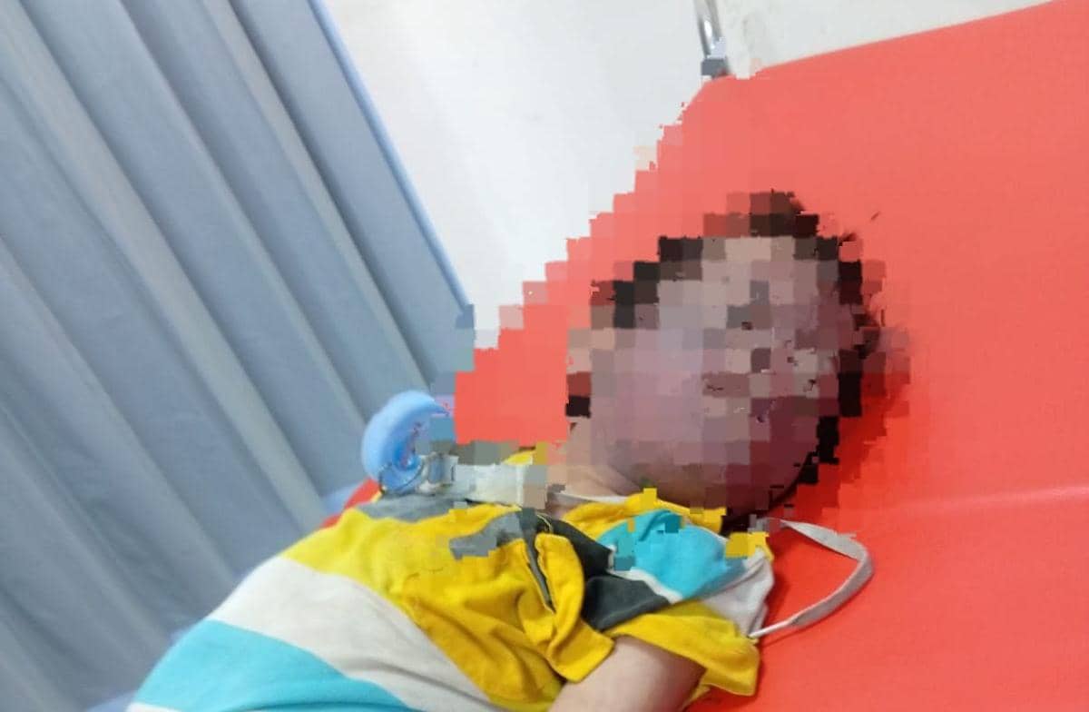 Anak Down Syndrome di Rungkut Surabaya Meninggal Diduga Korban Bullying