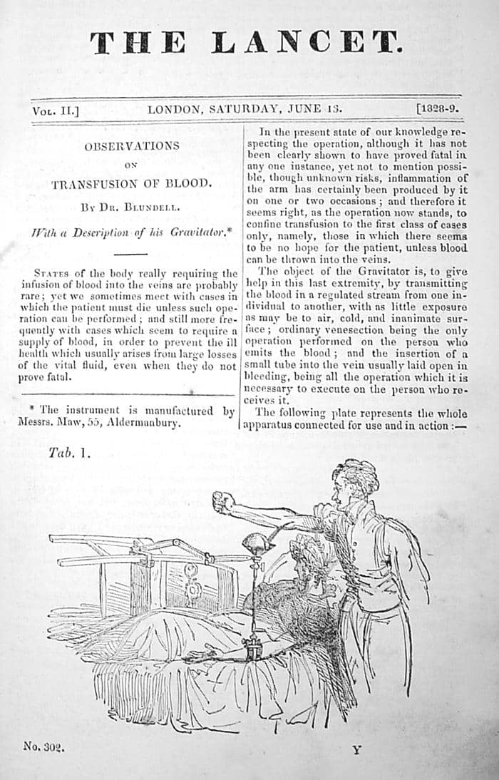 Halaman jurnal medis The Lancet edisi 13 Juni 1829 memuat artikel James Blundell tentang alat transfusi darah.