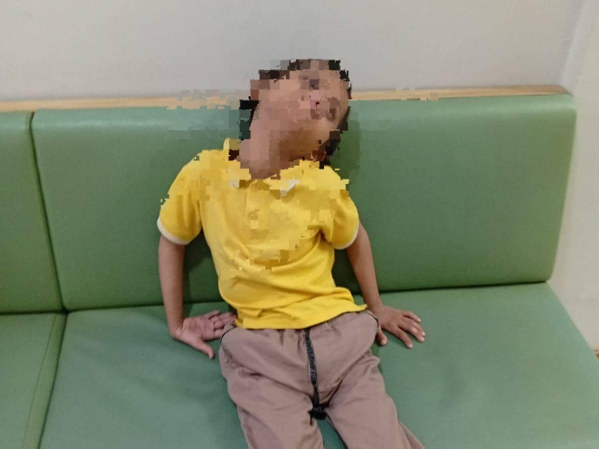 Pelaku Perundungan Anak Down Syndrome di Surabaya Dibawa ke RS Menur