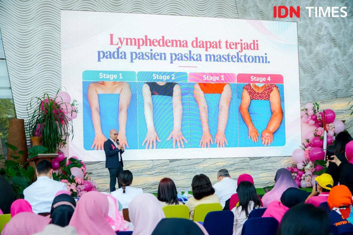 Bahayakah Pembengkakan Tangan Setelah Operasi Kanker Payudara?