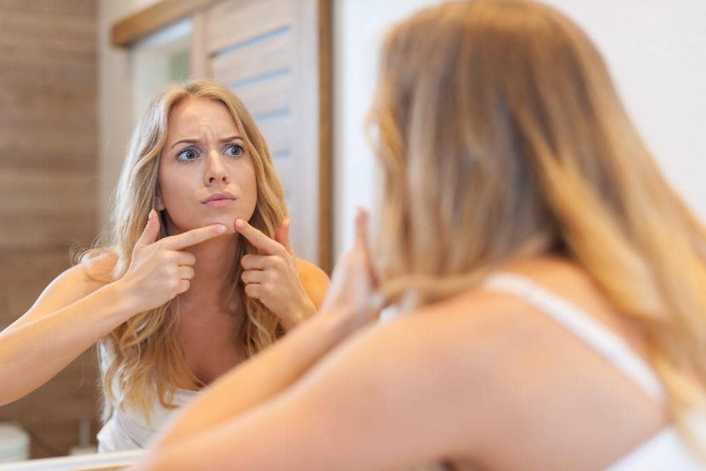 Kenapa Rambut Bisa Tumbuh di Dagu Perempuan?