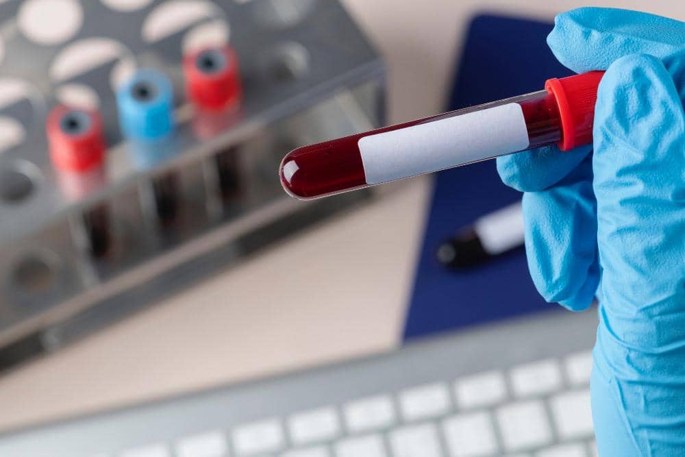 Sample darah yang akan diperiksa di laboratorium
